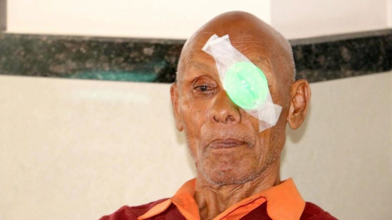 Patient after Operation