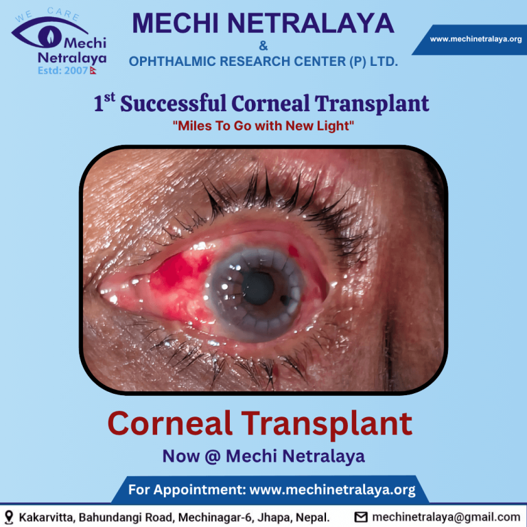 close-up of human eye with corneal transplant text overlay