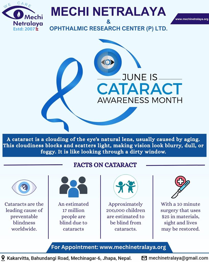 CATARACT-SURGERY-MECHI-NETRALAYA